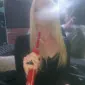 اِکس‌دال‌پارتزِکس